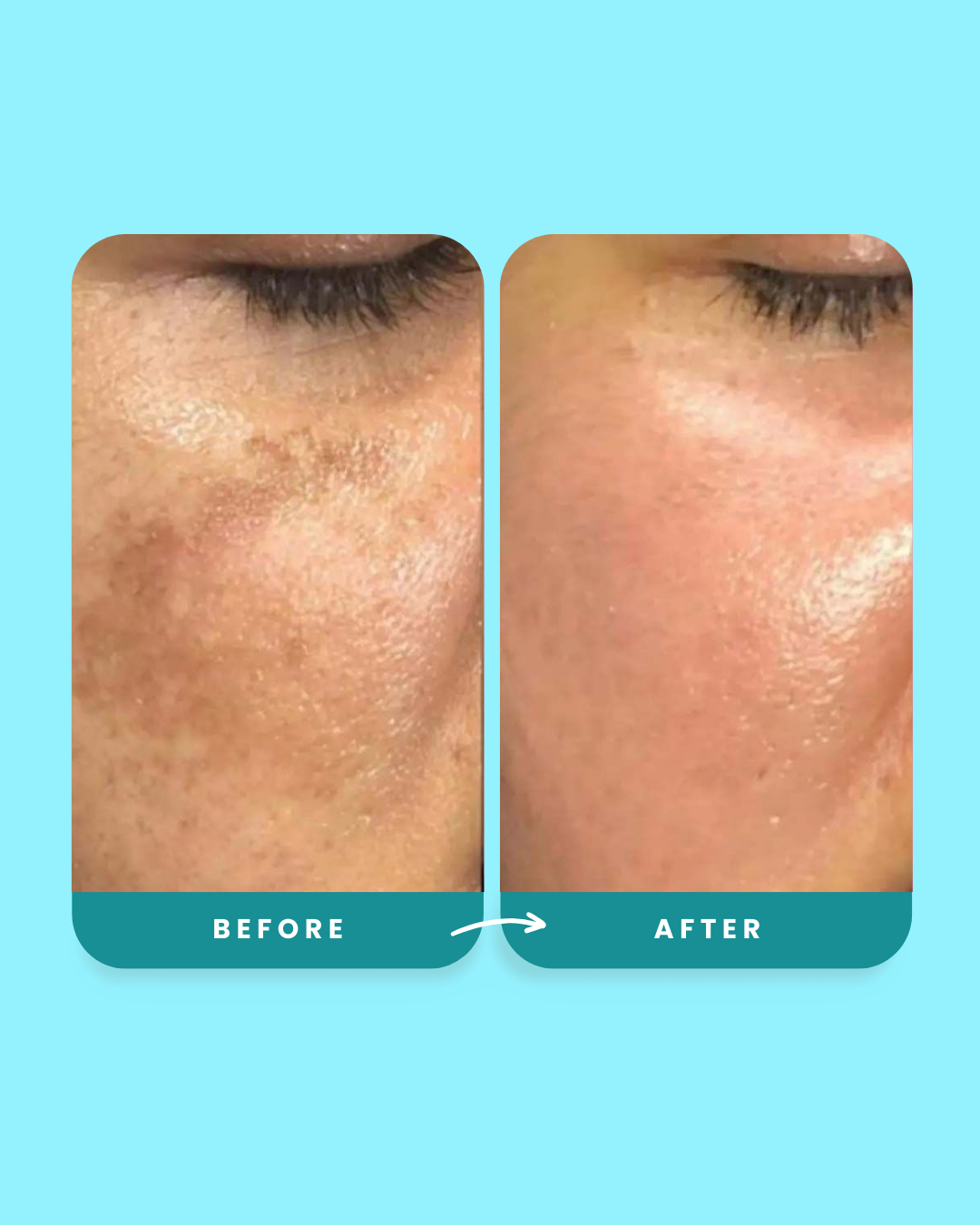 Alpha Glow Serum