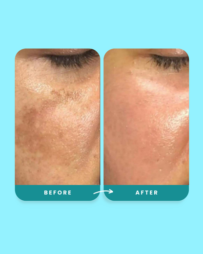 Alpha Glow Serum