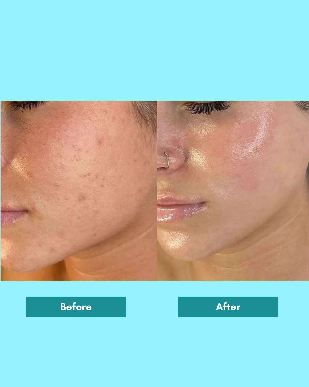 Alpha Glow Serum