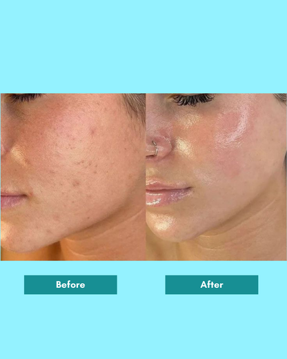 Alpha Glow Serum